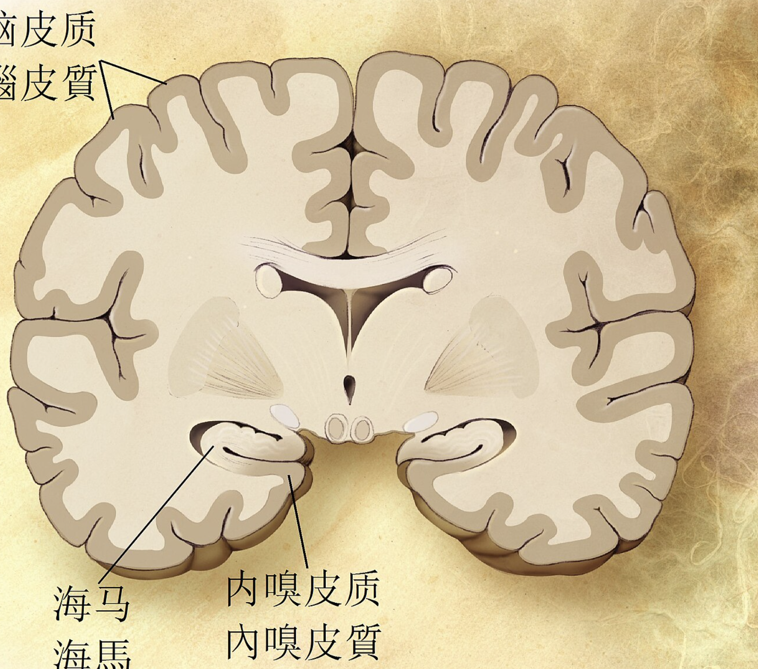 阿尔茨海默病
