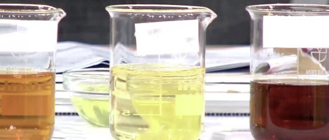 晨尿颜色与气味的健康警示：不可忽视的身体信号