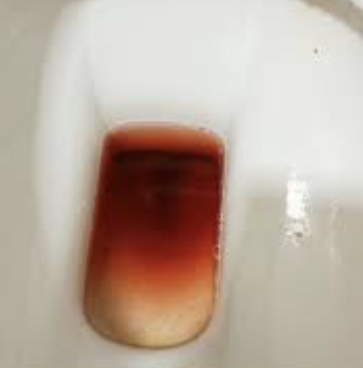 大便带血，不痛不痒是什么病？