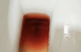 大便带血，不痛不痒是什么病？