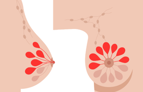 乳腺增生的症状有哪些？科学调理方法与日常护理全解析
