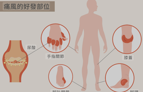 痛风加重的六个报警信号，痛风症状怎么缓解？权威科普详解