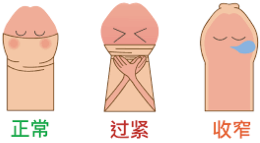 儿童包皮过长一定要手术吗？5种情况不适合割包皮