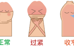 儿童包皮过长一定要手术吗？5种情况不适合割包皮
