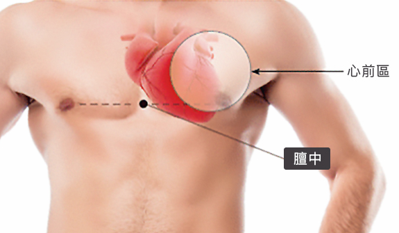 突发心绞痛怎么办？冠心病急救方法与自救知识