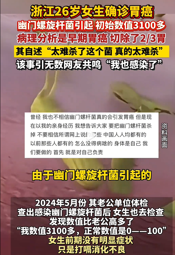 幽门螺杆菌复发几率大吗？彻底清除幽门螺杆菌的实用指南