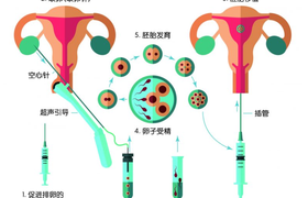 婴儿胚胎被冷冻还可以移植入子宫吗