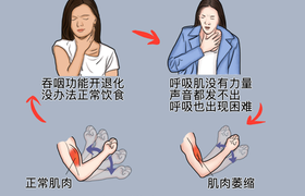 渐冻症能活多久