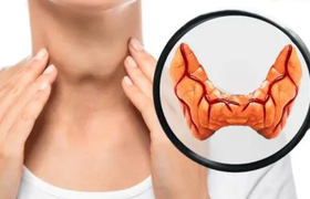 甲状腺炎怎么治疗