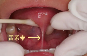 大舌头能做手术吗