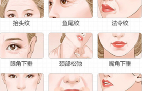 做小拉皮手术需要多少钱