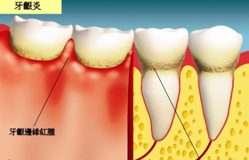 门牙疼是什么原因