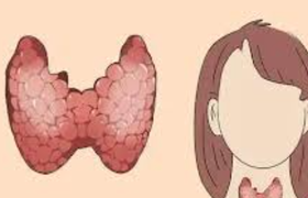 结节是什么意思