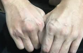 青筋明显是什么原因