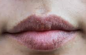 嘴唇发紫是怎么回事