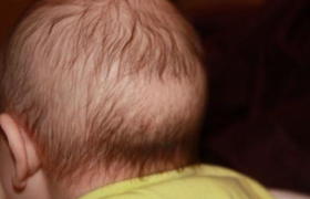 枕秃是什么意思