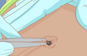 肚脐眼有臭味怎么回事